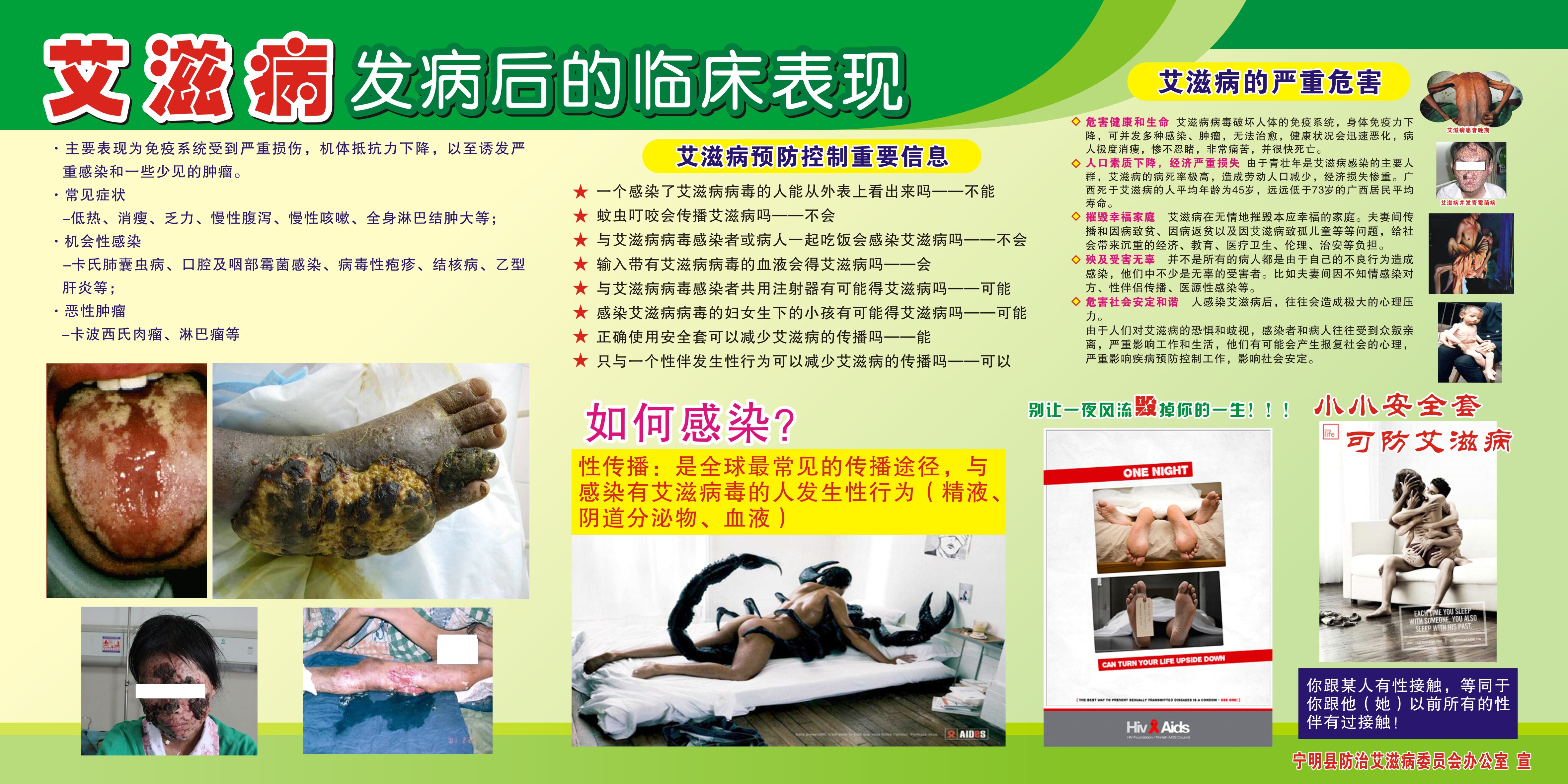 艾滋病临床.jpg